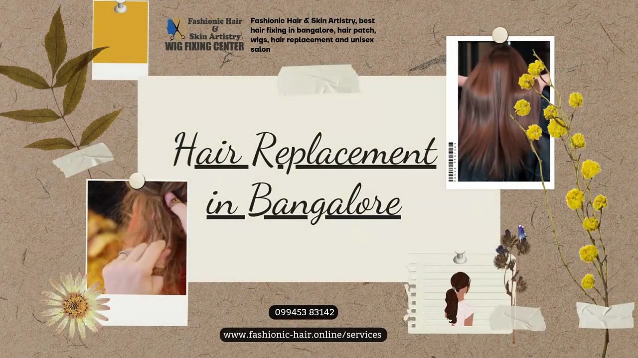 Hair Replacement in Bangalore