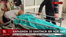 Adana'da sokak köpeklerinin saldırısına uğrayan genç kız yaralandı