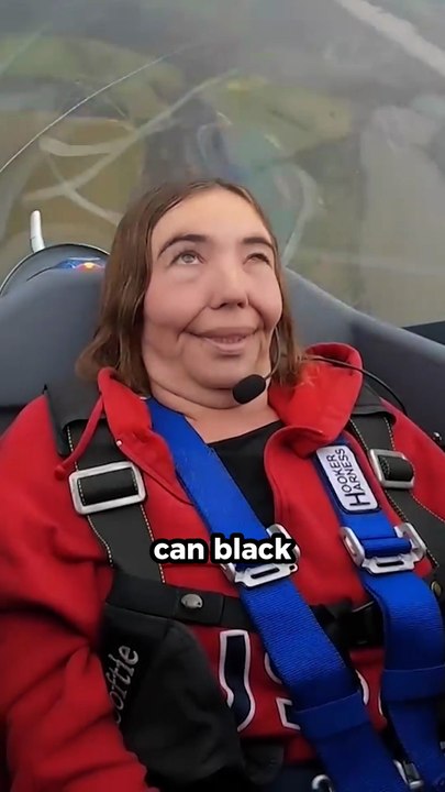 Why Woodpeckers Never Get Concussions #facts #shorts #viral