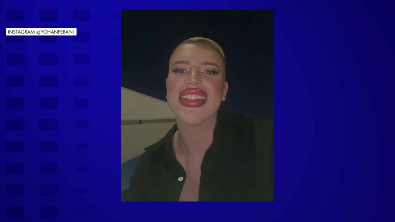 Influenceur : les Français payent une chirurgie ratée