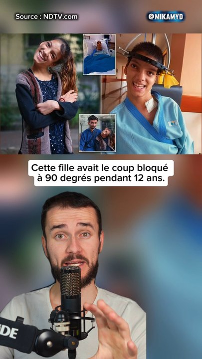 Cette fille avait le coup bloqué à 90 degrés pendant 12 ans.