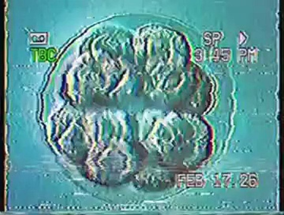 ヴィニシウスの冒険 - 今日私はほぼCSIの強盗です - TV TOTYO - (2000)