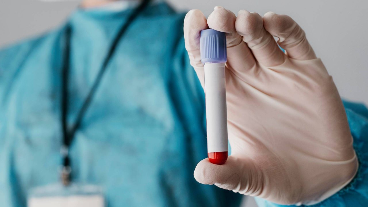 ¿Cómo tratar la hemofilia? Este es el riesgo si no entregan los medicamentos a tiempo