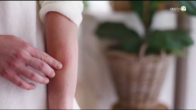 Alertan a Bahía de Banderas por alto número casos de sarampión en Vallarta