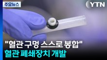 "혈관 구멍 스스로 봉합"...차세대 혈관 폐쇄장치 개발 / YTN