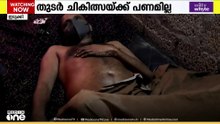 തുടർ ചികിത്സയ്ക്ക് പണമില്ല ; പ്രതിസന്ധിയിലായി തൊടുപുഴ സ്വദേശിയും കുടുംബവും