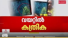 ഇതെന്ത് സിസ്റ്റം? ഉഷയുടെ വയറ്റിൽ കത്രിക കുടുങ്ങിയത് 5 വർഷം മുമ്പ്