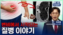 [메디컬 인사이트 124회] 변비를 방치하면 생기는 질병들 / YTN