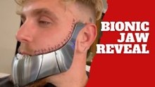 Jake Paul shocks fans with “bionic jaw” reveal and unexpected AI twist