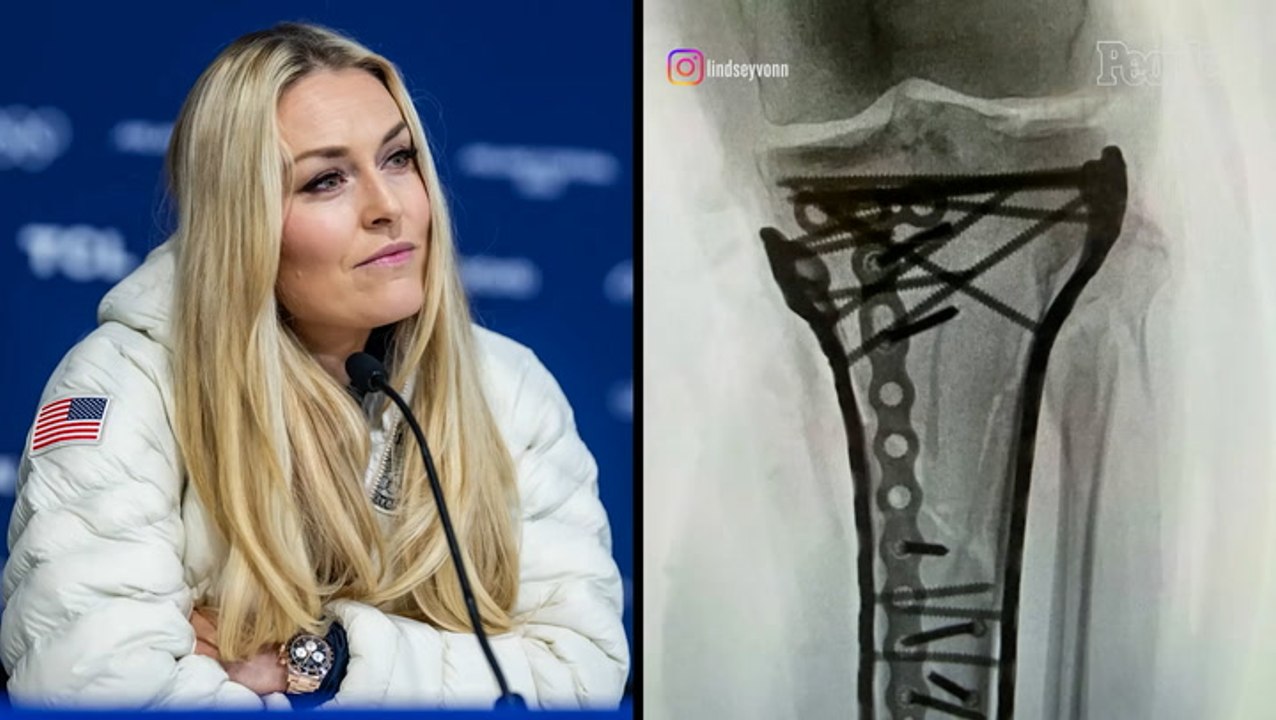 Lindsey Vonn 'Struggling' After Her Fifth Surgery to Correct Injuries from Her Olympics Crash