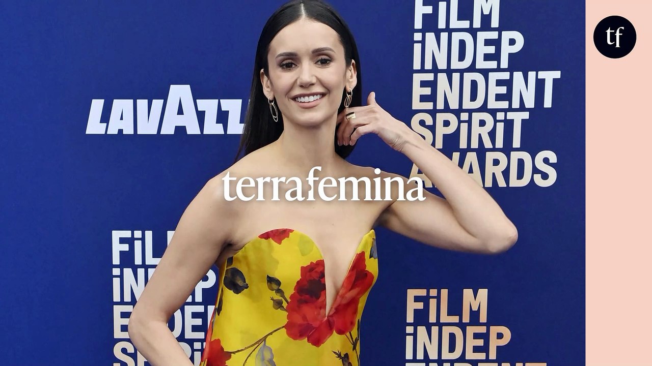 Cette actrice d'une série hyper culte des années 2000 victime de botox-shaming, et si on arrêtait de tacler les meufs qui font de la chirurgie ?