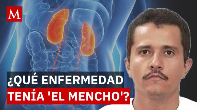 Esta era la enfermedad que padecía 'El Mencho', líder del CJNG abatido