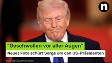 Donald Trump krank?: "Geschwollen vor aller Augen" - neues Foto schürt Sorge um den US-Präsidenten