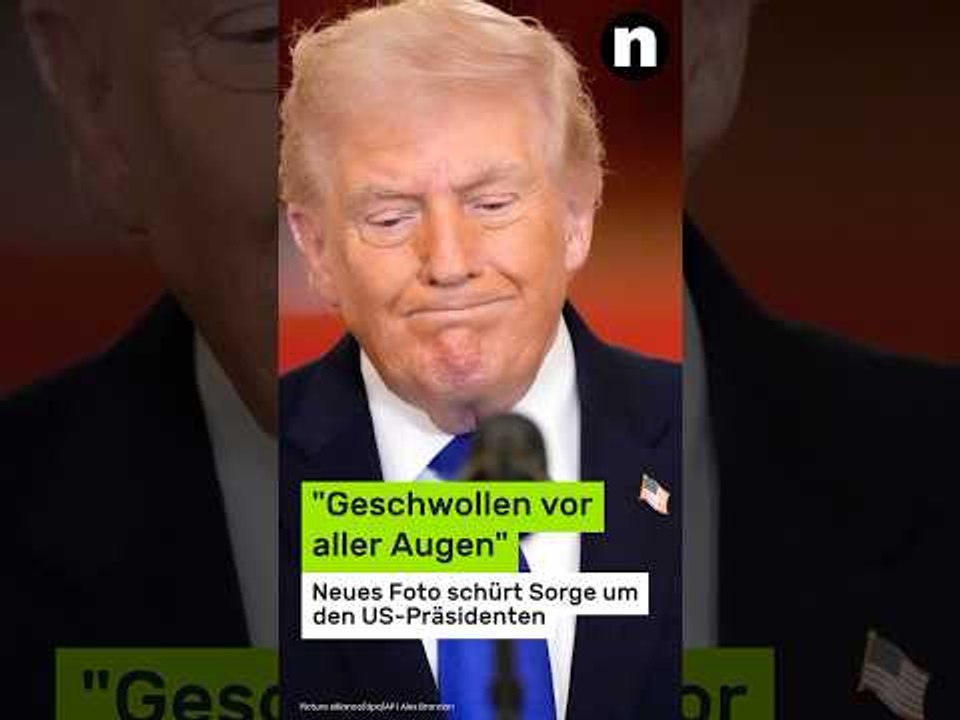 Donald Trump krank?: 'Geschwollen vor aller Augen' - neues Foto schürt Sorge um den US-Präsidenten