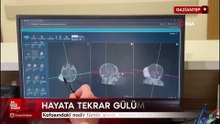 Gaziantep'de kafasındaki nadir tümör alındı hayata tekrar gülümsedi