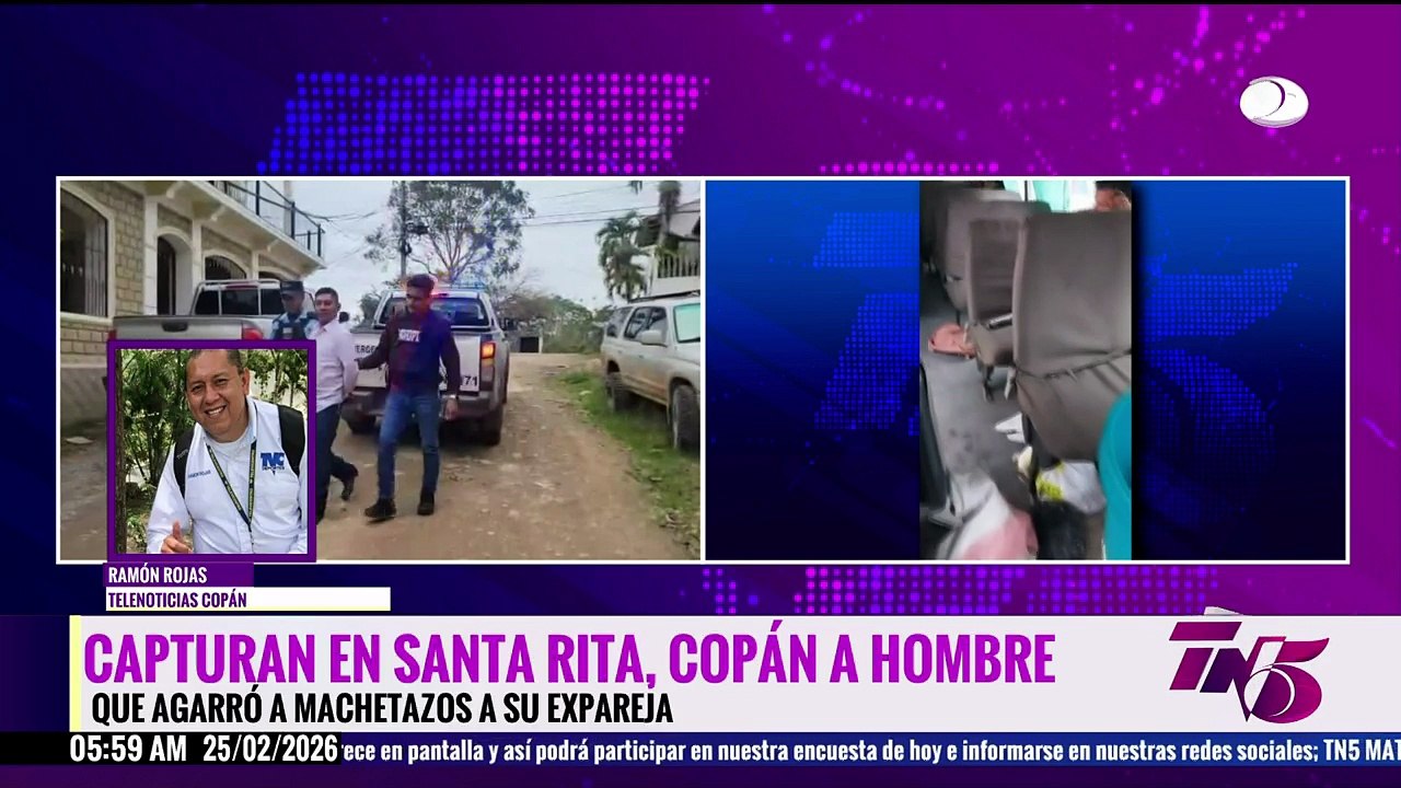 Ataque con machete en bus de Copán: hombre hiere a su expareja por celos