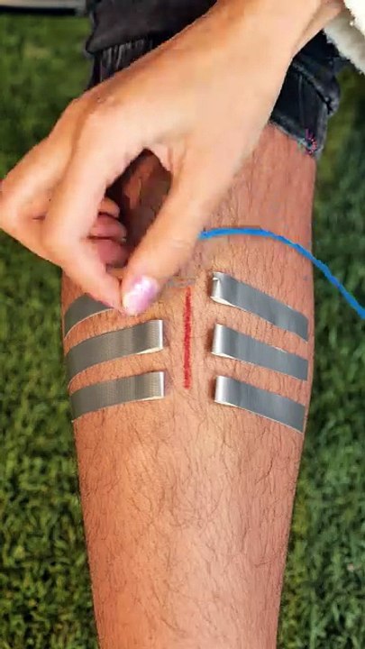 How to patch wounds in urgent situations