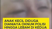 Anak Kecil Diduga Dianiaya Oknum Polisi Hingga Lebam di Kedua Mata, Kabid Propam: Paminal Sudah Turun