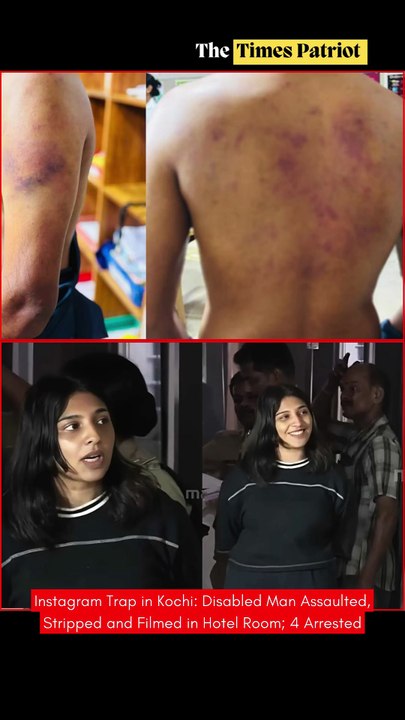 Instagram Trap in Kochi: Disabled Man Assaulted, Stripped and Filmed in Hotel Room; 4 Arrested