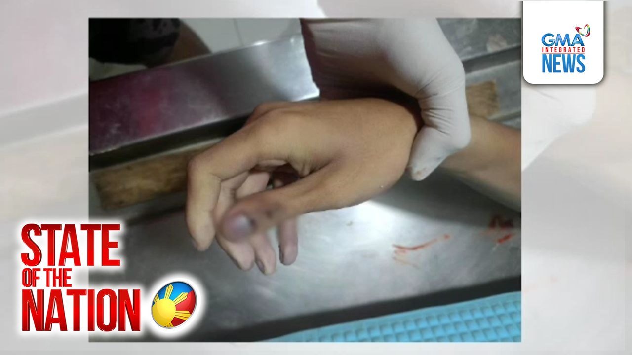 19-anyos na lalaki, patay dahil umano ng hazing; 3 naghatid sa kanya sa ospital, hinahanap | SONA