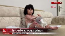Bursa'da  4 yaşındaki İbrahim, kelebek hastalığı nedeniyle kıyafet giyemiyor