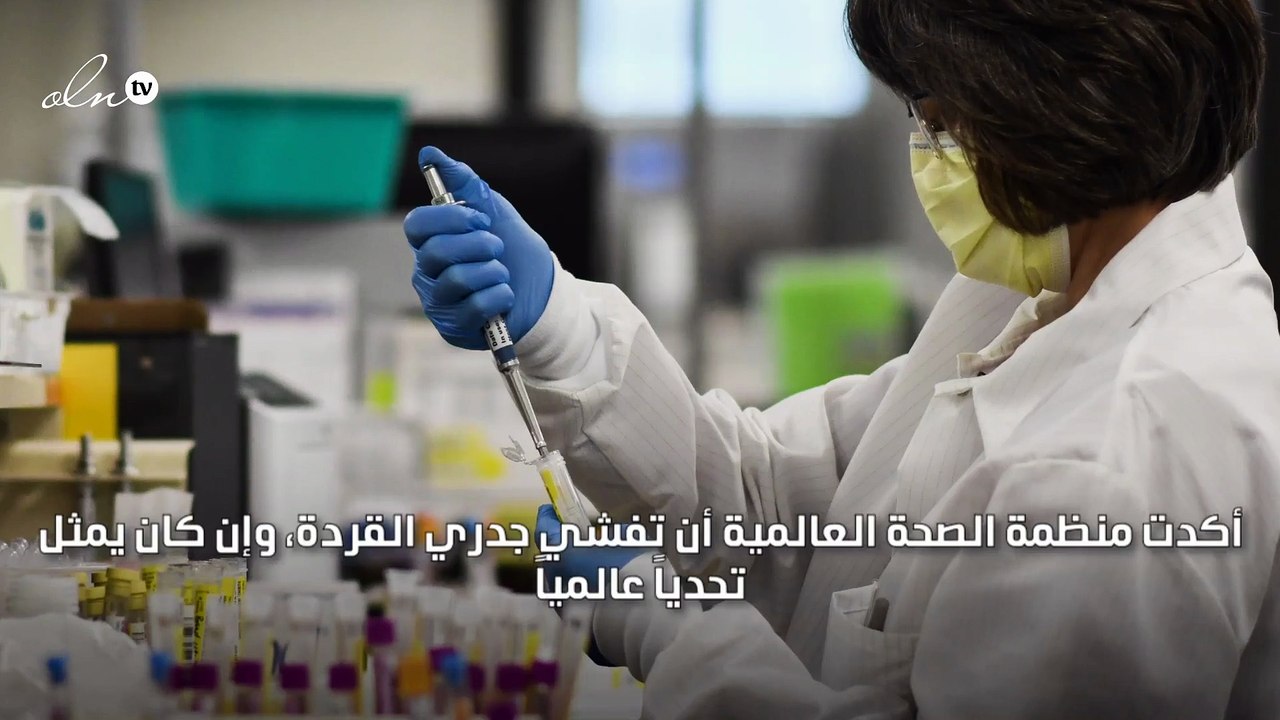 الصحة العالمية تؤكد أن جدري القردة ليس "كوفيد الجديد"