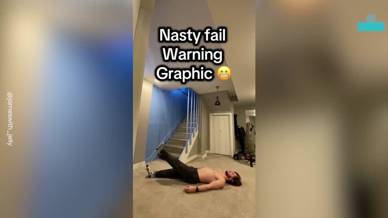 Man Attempts Handstand After Broken Wrist