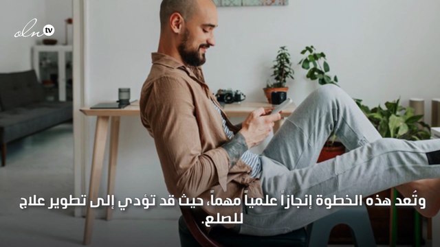 علاج الصلع بات حقيقة بفضل تقنية الطباعة ثلاثية الأبعاد