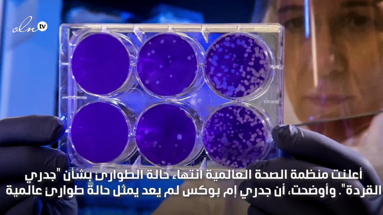 الصحة العالمية تعلن انتهاء حالة الطوارئ بشأن "جدري القردة"