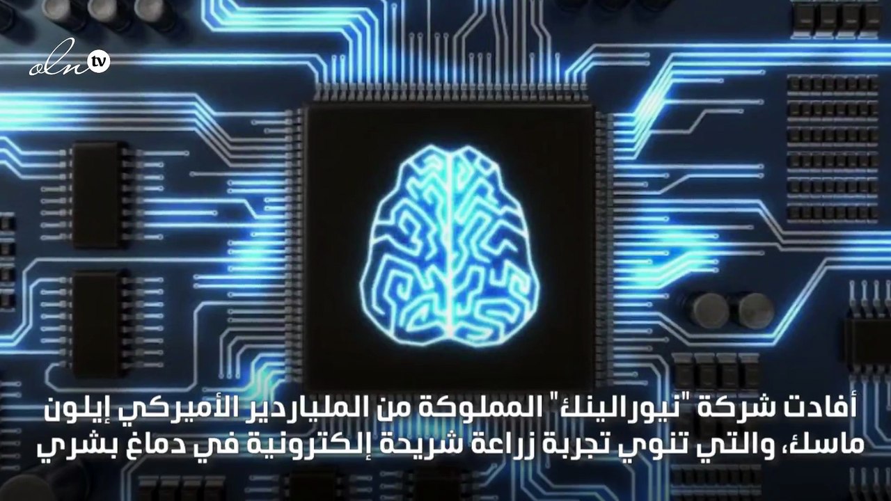 أمريكا تسمح لشركة تابعة لايلون ماسك بزراعة شريح...