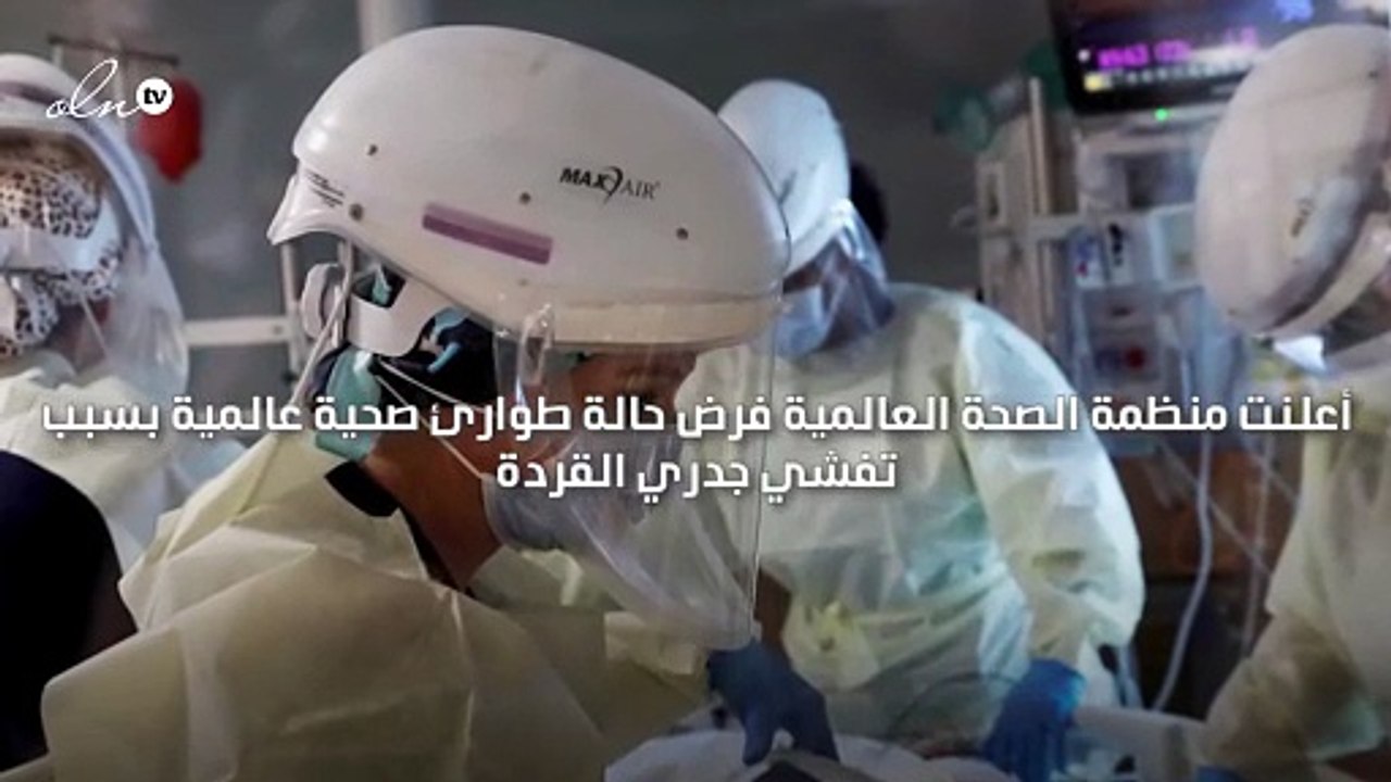 الصحة العالمية تعلن حالة الطوارئ صحية عالمية بعد تفشي جدري القردة