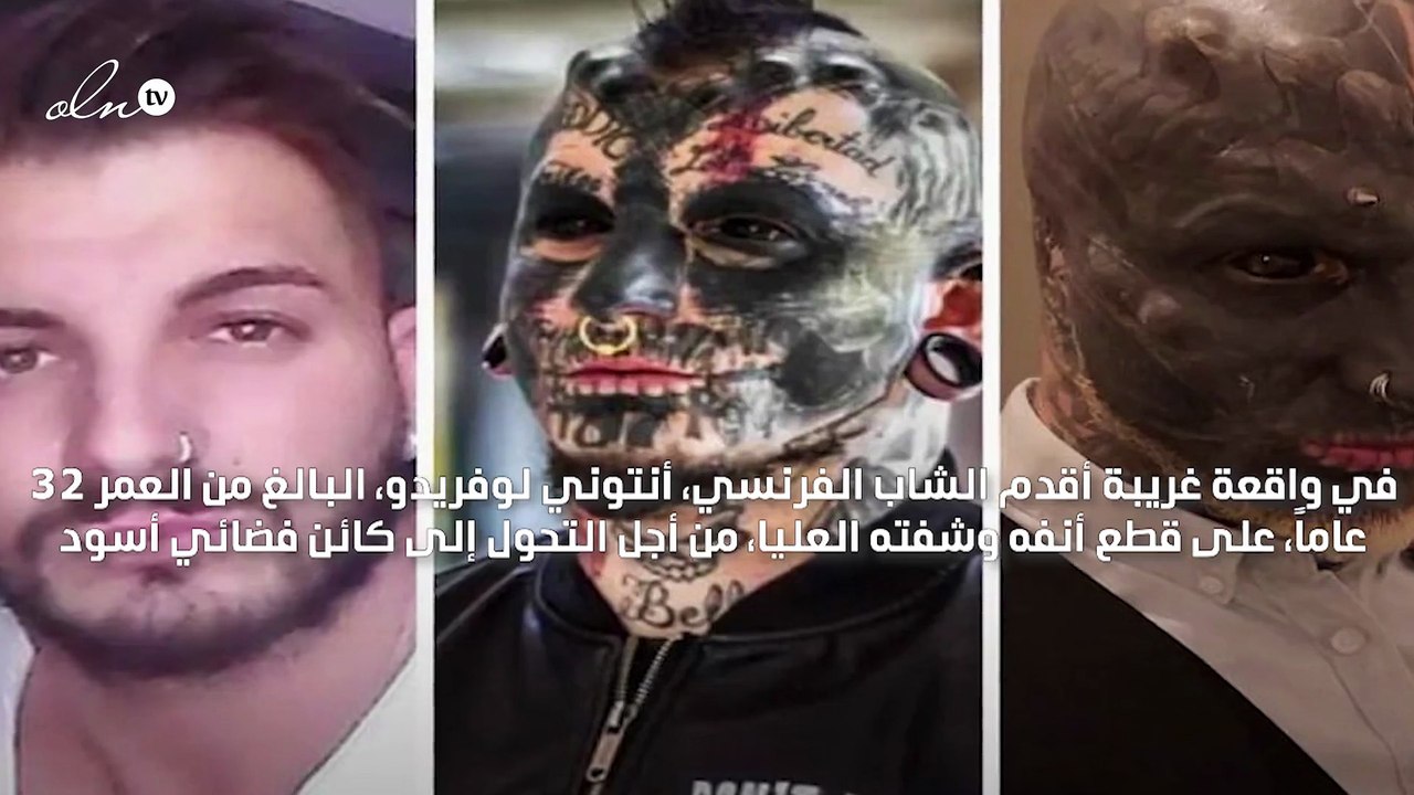 فرنسي يقطع أنفه وشفته العليا ليتحول إلى كائن فضائي