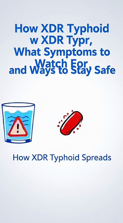 How XDR Typhoid Spreads, What Symptoms to Watch For, and Ways to Stay Safe