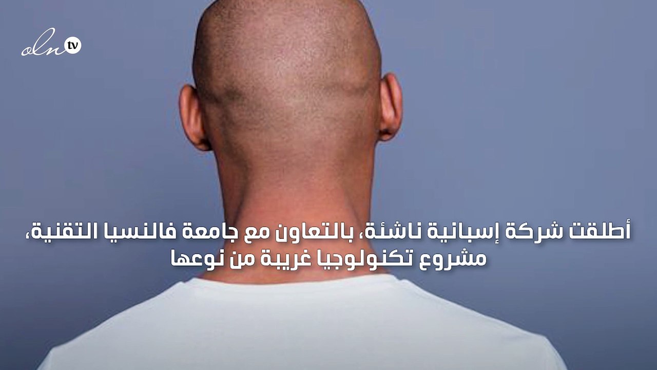 ابتكار تقنية جديدة لتوليد الطاقة من صلعة الرجال