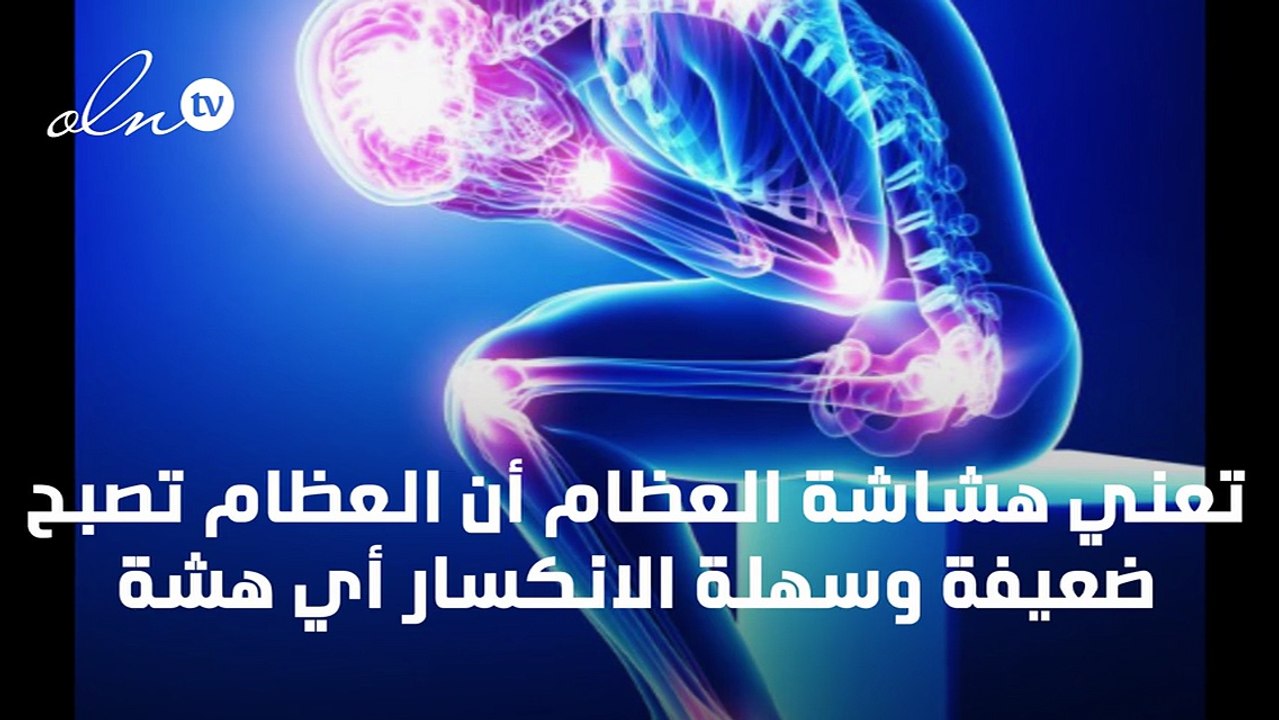 اعراض هشاشة العظام