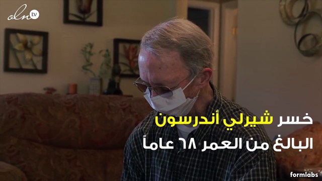 يخفي وجهه عن العالم منذ سنوات... ما هو الشيء الذي لا يريد أن يراه أحد؟