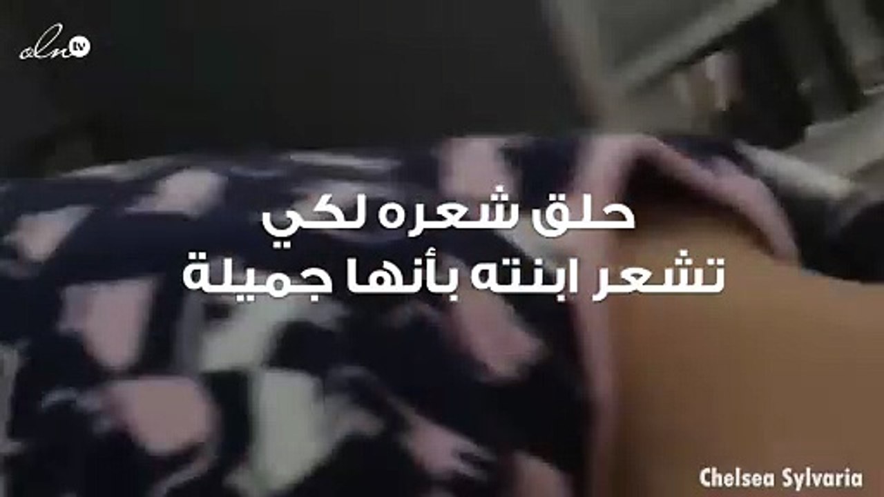 خسرت ابنته شعرها إلى الأبد فباتت "لا تحب نفسها"... ما فعله لاحقاً لم يكن متوقعاً