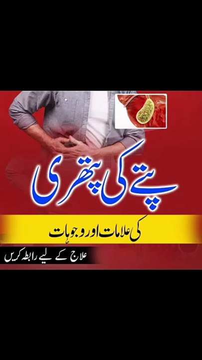 Gallbladder Stone Symptoms & Treatment | Pitta ki Pathri #homeopathy #drjadran