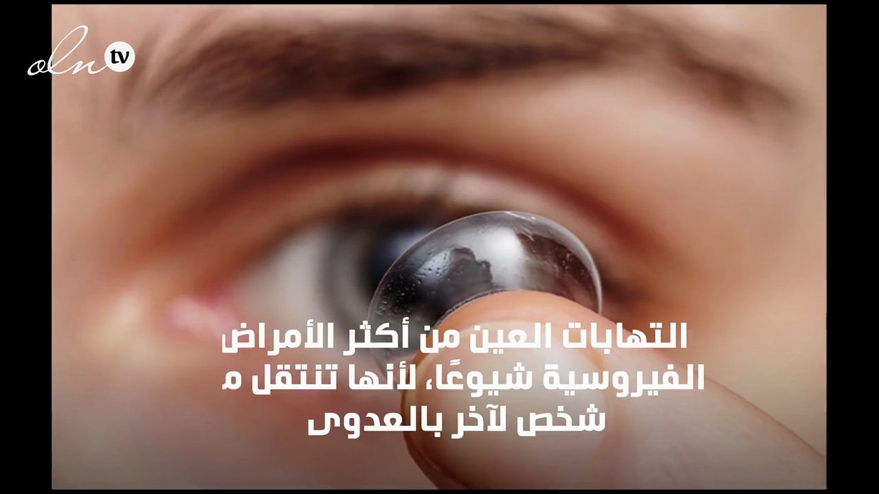 اعراض التهاب العين