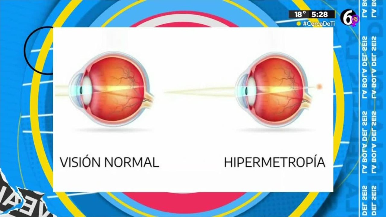 Conoce los diferentes padecimientos de la vista y sus diferencias