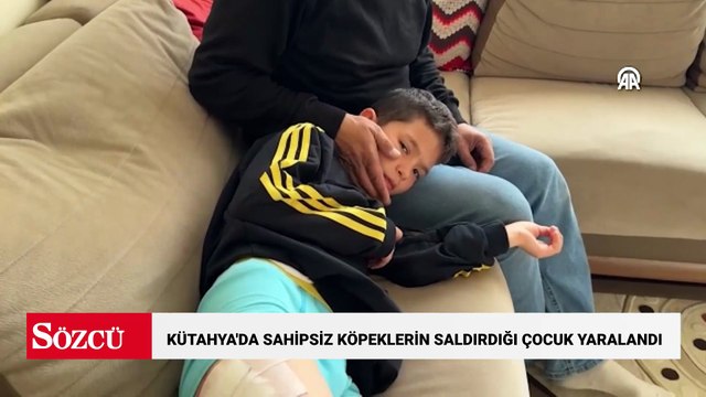 Kütahya'da sahipsiz köpeklerin saldırdığı çocuk yaralandı