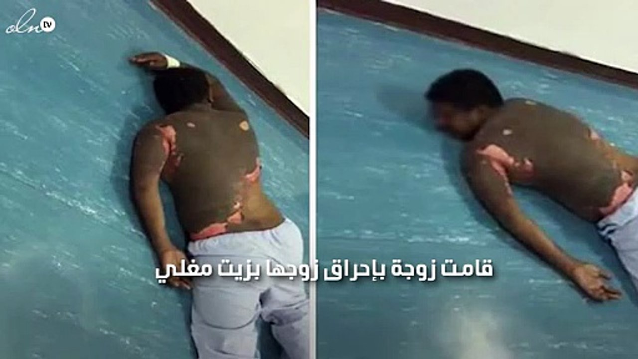 تحرق زوجها بالزيت المغلي .. والسبب