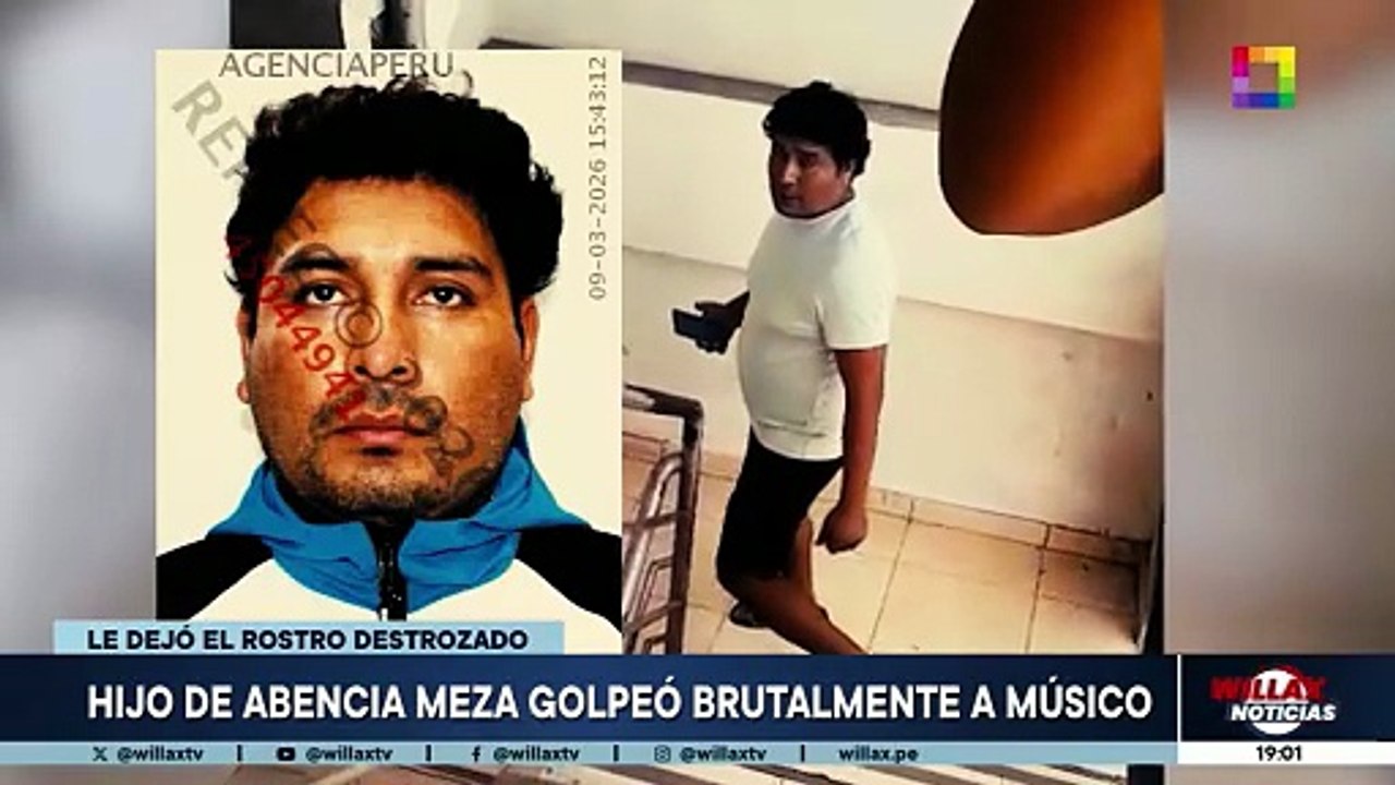 HIJO DE ABENCIA MEZA GOLPEÓ A MÚSICO | Willax