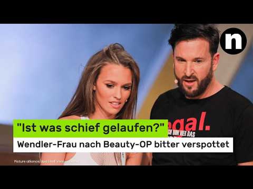 Laura Müller: 'Ist was schief gelaufen?' - Wendler-Frau nach Beauty-OP bitter verspottet