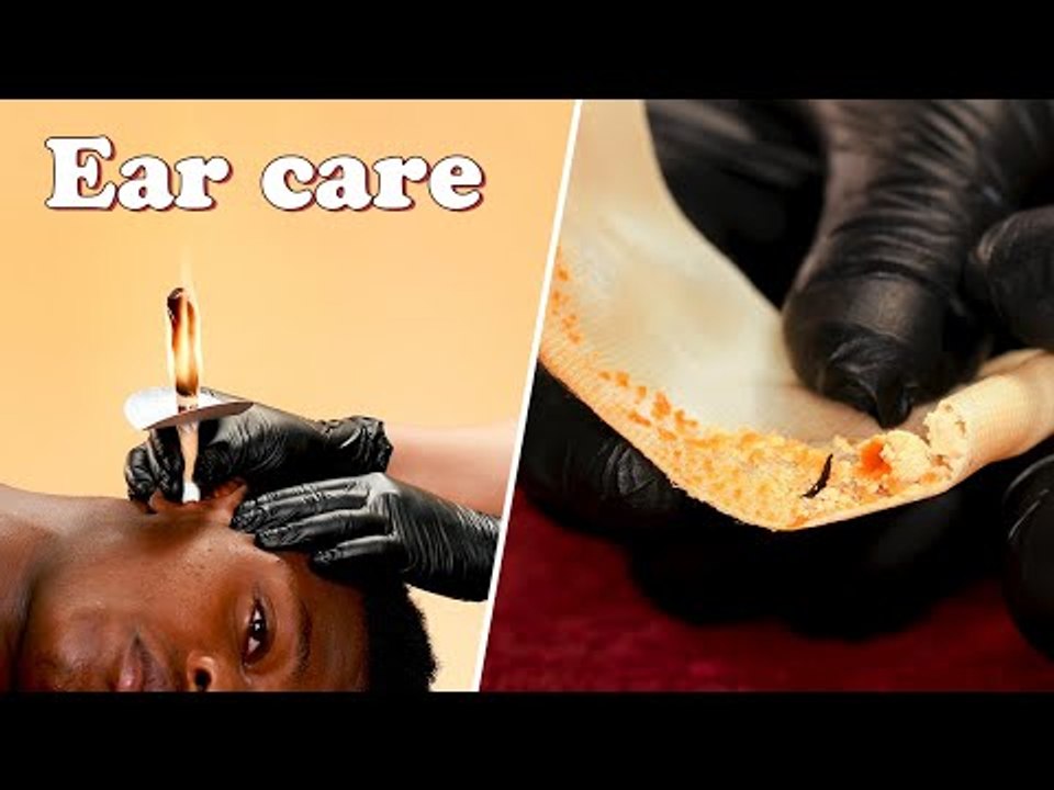 Men's Facial With Relaxing Ear Care & Ear Candling