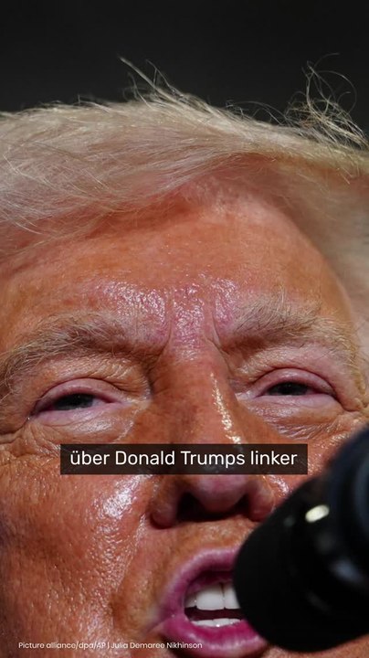 No Glomex Donald Trump gestürzt?: Rätselhafter Bluterguss im Gesicht - Weißes Haus schweigt zu Trump-Verletzung