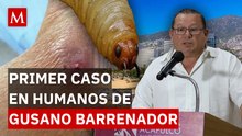 Primer caso de gusano barrenador en humanos enciende alerta sanitaria en Acapulco
