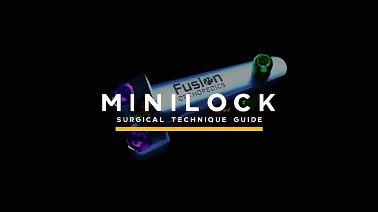 Minilock Correction Explained | How to Fix and Optimize Minilock Performance