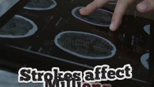 Swiss Microbots Enter Blood Vessels to Break Clots From Inside | Scientific Future of Medicine