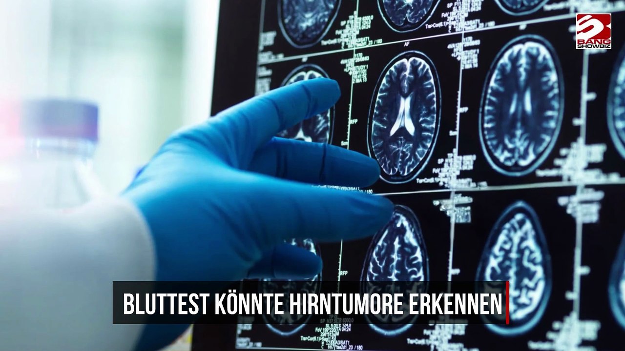 Bluttest könnte Hirntumore erkennen